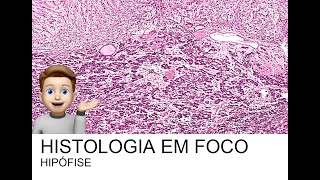 HISTOLOGIA EM FOCO HIPÓFISE [upl. by Had612]