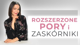 ROZSZERZONE PORY i ZASKÓRNIKI  Schemat domowej pielęgnacji  👍 [upl. by Barimah]