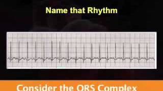 Introduction to EKG Rhythm Interpretation Part 2 [upl. by Ayotol981]