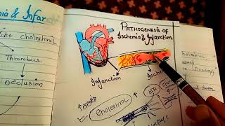 pathogenesis of ischemia and infarction NGMedicals [upl. by Adna710]