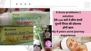 Aziderm 10 cream review how to use aziderm 10 cream aziderm review skincare youtube [upl. by Eldwon318]