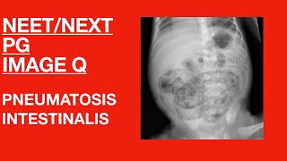 NEETNEXT PGFMGE  IMAGE Q  Pediatrics  Radiology  Pneumatosis Intestinalis [upl. by Leihcim947]