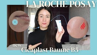 La Roche Posays NEW Cicaplast Baume B5 Review  Before amp Afters  Mini Review of the OG [upl. by Straus]