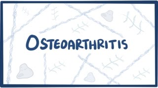 Osteoarthritis  causes symptoms diagnosis treatment amp pathology [upl. by Swetlana199]