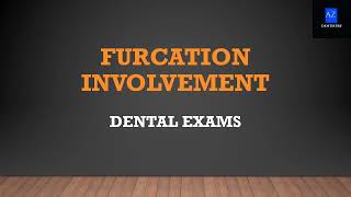 MCQs on Periodontics  Furcation involvementDental PSC Exams [upl. by Yssac]