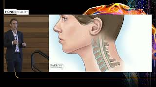 Cervical Myelopathy amp Radiculopathy  Core Knowledge for Management and Surgical Treatment [upl. by Onaicul901]