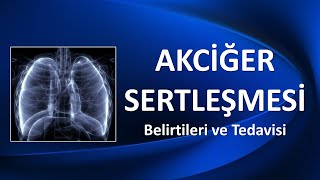 AKCİĞER SERTLEŞMESİ Belirtileri ve Tedavisi [upl. by Etnelav346]