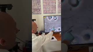 what is in your blood medicine microscope doctor channel shorts [upl. by Ailugram]