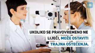 Konjunktivitis  uzroci i simptomi upale [upl. by Auhoj]