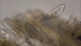 Paramecium caudatum under the microscope [upl. by Raynell758]