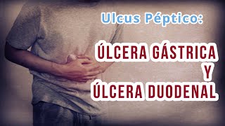 ÚLCERA GÁSTRICA Y DUODENAL Definición causas Diagnóstico diferencial y Tratamiento [upl. by Eecyal]