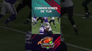 La importancia de las Conmociones Cerebrales y el impacto que tiene en la NFL 🏈🤕 [upl. by Rapsac]