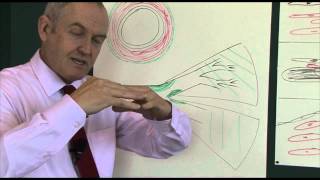 Heart disease 6 Pathophysiology of coronary heart disease [upl. by Ayerhs]