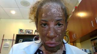 Dr Erinn Harris quotVitiligo Healing Journey Recommendations for Makeupquot  Episode 7 [upl. by Htidirem]