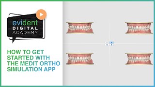 How to Get Started with the Medit Ortho Simulation App [upl. by Kissner]