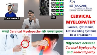 Cervical Myelopathy Physiotherapy Treatment  Causes Symptoms Test amp Grading  NO SURGERY NEEDED [upl. by Yenhoj882]