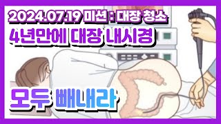 대장내시경 여전히 먹기힘든 약약먹고 물마시는게 제일 힘들었어요 [upl. by Ettenowtna]