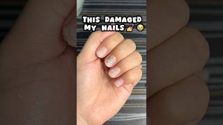 Nail extensions ki galti 😭😭nails nailsextension viralvideo shortsfeed viralshort trending [upl. by Weslee357]