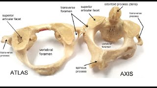 Two Minutes of Anatomy Cervical Atypical Vertebra [upl. by Lilas]