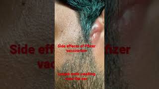 Pfizer side effects Lymph node swelling [upl. by Disini]