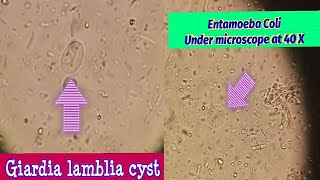 Difference between Giardia Lamblia amp Entamoeba Coli cystBest view under microscope at 40 X [upl. by Jt169]