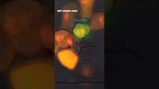 CANCER CELLS amp NATURAL KILLER CELLS  MICROSCOPE 🔬  cancercells ytshorts labtechnician bmlt [upl. by Llenol548]