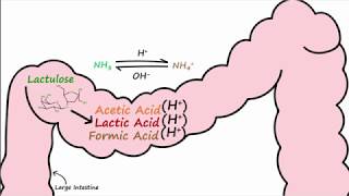 Hepatic Encephalopathy and Lactulose [upl. by Payne828]