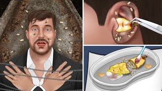 ASMR Remove queen termite from MrBeasts ear  Ear Cleaning Animation [upl. by Itraa899]