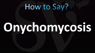 How to Pronounce Onychomycosis correctly [upl. by Lerual]