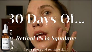 I Used The Ordinary 1 Retinol in Squalane For 30 Days  Acne Scarring Before and After [upl. by Poulter]