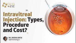 Intravitreal Injection Types Procedure and Cost Dr Anisha Gupta  Eye Specialist Delhi Excel Eye [upl. by Dhruv330]