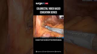 Hindgut Session 2 Mastering the Left Colon Mobilization Dissection Resection and Troubleshooting [upl. by Macgregor]