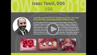 Intensify and Densify Your Implant Practice  Dr Isaac Tawil [upl. by Oneladgam706]