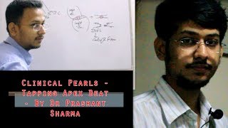 Clinical pearl  Tapping Apex Beat Pathophysiology [upl. by Eam845]