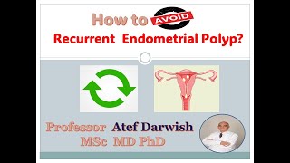 How to avoid Recurrent Endometrial polyp [upl. by Schnabel]