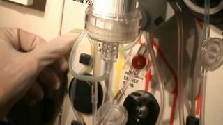 DIALYSE  VIDEO 18 hemodialyse mise en place du set partie 1 [upl. by Nosnehpets696]