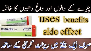 clinajel cream for acne pimple and dark spotbenefits side effect usesclinajel uses in urdu hindi [upl. by Hsirap]