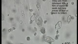 Zoospores swimming Phytophthora sp [upl. by Nyret]