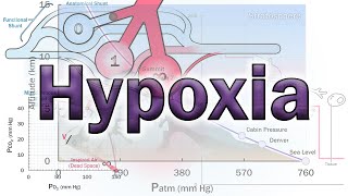 Hypoxia and the VQ Ratio  Physiology of Respiratory Failure [upl. by Gittle]