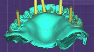 Exocad Tutorial How to Separate the Jaw from a 360 Denture Scan for AllonX Design [upl. by Urbana]