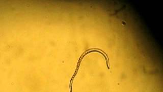 Strongyloides stercoralis filariform larvae [upl. by Lissa]