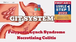 Polyposis Syndrome Lynch Syndrome Necrotizing Colitis first aid step 1USMLEUrduHindi [upl. by Sclater]