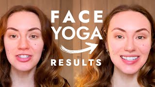 Real Results Of Face Massages beautytips [upl. by Nurav]