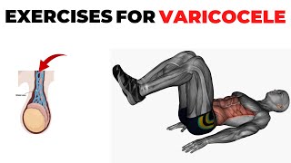 Exercises To Treat Varicocele for Men [upl. by Meeks]