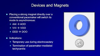 ICDs and Biventricular Pacemakers [upl. by Treulich]