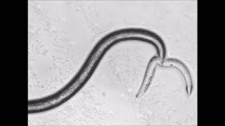 Predator Nematode  Omnivorous nematode [upl. by Narat]