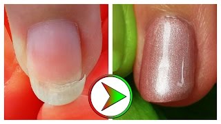 extrem eingebrochenen Nagel retten  Tutorial Nagelreparatur amp Reinigung [upl. by Anavrin]