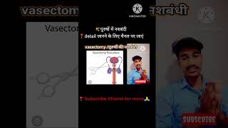 💉नशबंदीvasectomy medical procedureanatomypopularmosttrendingwowviralvideo [upl. by Eversole]