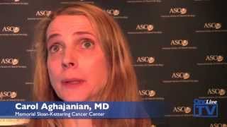 Dr Aghajanian Discusses PARP Inhibitors for the Treatment of Ovarian Cancer [upl. by Eidod]