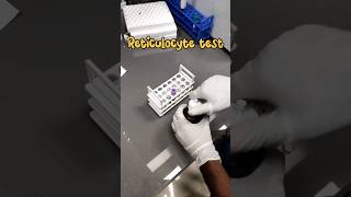 Reticulocyte count 🧑‍🔬🔬 medical lab Reticulocytecount youtubeshorts mbbs shortsmedicallabtech [upl. by Chap]